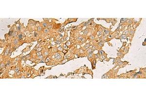 Immunohistochemistry (Paraffin-embedded Sections) (IHC (p)) image for anti-Chemokine (C-X-C Motif) Ligand 1 (Melanoma Growth Stimulating Activity, Alpha) (CXCL1) antibody (ABIN7248116)