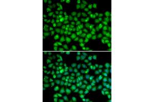 Immunofluorescence analysis of U2OS cells using ARRB2 antibody. (Arrestin 3 抗体)