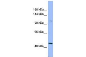 Image no. 1 for anti-Xylosyltransferase II (XYLT2) (AA 575-624) antibody (ABIN6741764) (XYLT2 抗体  (AA 575-624))