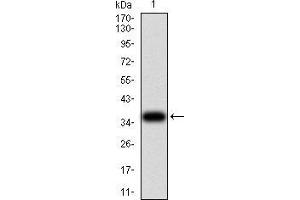 Western blot analysis using PLCG1 mAb against human PLCG1 (AA: 1192-1291) recombinant protein.