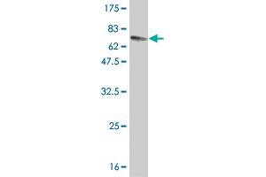 Western Blotting (WB) image for anti-Neurotrophic Tyrosine Kinase, Receptor, Type 2 (NTRK2) (AA 1-477) antibody (ABIN562055)