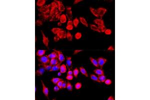 Immunofluorescence analysis of HeLa cells using TRPC6 antibody (ABIN7270918) at dilution of 1:100 (40x lens). (TRPC6 抗体  (AA 732-931))