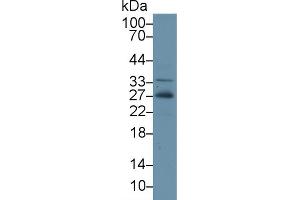 Western Blot; Sample: Human Hela cell lysate; Primary Ab: 2µg/ml Rabbit Anti-Gallus ADP Antibody Second Ab: 0. (ADIPOQ 抗体  (AA 32-244))
