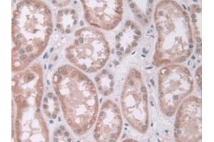 DAB staining on IHC-P;;Samples: Human Kidney Tissue (IDUA 抗体  (AA 28-306))