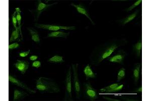 Immunofluorescence of purified MaxPab antibody to RANBP6 on HeLa cell. (RANBP6 抗体  (AA 1-1105))