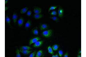 Immunofluorescent analysis of A549 cells using ABIN7156381 at dilution of 1:100 and Alexa Fluor 488-congugated AffiniPure Goat Anti-Rabbit IgG(H+L) (ITM2A 抗体  (AA 79-263))