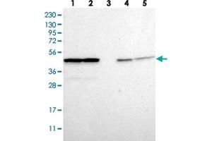 Western blot analysis of Lane 1: RT-4, Lane 2: U-251 MG, Lane 3: Human Plasma, Lane 4: Liver, Lane 5: Tonsil with PSMC5 polyclonal antibody  at 1:250-1:500 dilution. (PSMC5 抗体)