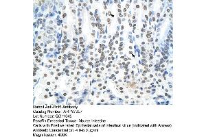 Mouse Pancreas (RNF6 抗体  (N-Term))