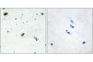 Immunohistochemistry analysis of paraffin-embedded human brain tissue, using ABL1 Antibody. (ABL1 抗体  (AA 861-910))