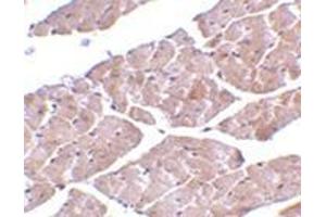 Immunohistochemistry (Paraffin-embedded Sections) (IHC (p)) image for anti-Transient Receptor Potential Cation Channel, Subfamily C, Member 3 (TRPC3) (C-Term) antibody (ABIN501062)
