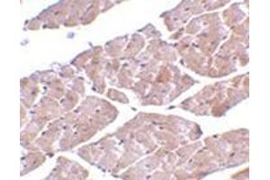 Immunohistochemistry of TRPC3 in mouse heart tissue with this product at 2 μg/ml. (TRPC3 抗体  (C-Term))