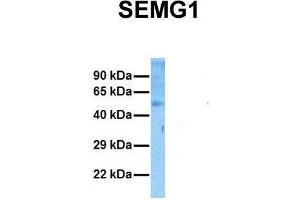 Host:  Rabbit  Target Name:  SEMG1  Sample Tissue:  Human Ovary Tumor  Antibody Dilution:  1. (SEMG1 抗体  (N-Term))