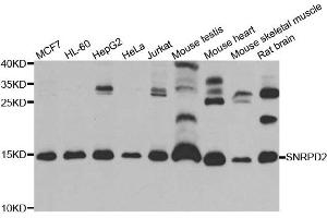 Western blot analysis of extracts of various cell lines, using SNRPD2 antibody. (SNRPD2 抗体)