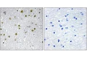 Immunohistochemistry analysis of paraffin-embedded human brain tissue, using NRIP2 Antibody. (NRIP2 抗体  (AA 1-50))