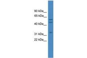 Image no. 1 for anti-ELK1, Member of ETS Oncogene Family (ELK1) (AA 301-350) antibody (ABIN6745314) (ELK1 抗体  (AA 301-350))