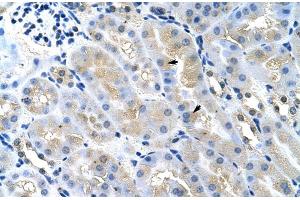 Immunohistochemistry (Paraffin-embedded Sections) (IHC (p)) image for anti-Tumor Susceptibility Gene 101 (TSG101) (Middle Region) antibody (ABIN2780037)