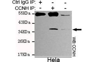 Immunoprecipitation analysis of Hela cell lysates using Cyclin H mouse mAb. (Cyclin H 抗体)