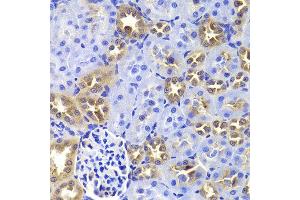 Immunohistochemistry of paraffin-embedded Rat kidney using GIP antibody at dilution of 1:100 (x400 lens). (GIP 抗体)