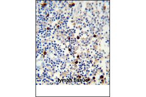 Lambda light chain Antibody (ABIN1539834 and ABIN2843347) immunohistochemistry analysis in formalin fixed and paraffin embedded human lymph tissue followed by peroxidase conjμgation of the secondary antibody and DAB staining. (Lambda-IgLC 抗体)