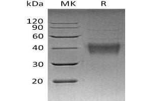 Western Blotting (WB) image for Tumor Necrosis Factor (Ligand) Superfamily, Member 9 (TNFSF9) (Active) protein (His tag) (ABIN7320663)