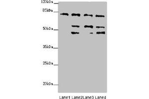Western blot All lanes: ZFYVE1 antibody at 6. (ZFYVE1 抗体  (AA 1-280))