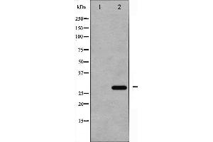 Western blot analysis of p27 Kip1 phosphorylation expression in EGF treated HeLa whole cell lysates,The lane on the left is treated with the antigen-specific peptide. (CDKN1B 抗体  (pThr187))