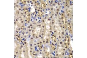 Immunohistochemistry of paraffin-embedded mouse kidney using SMARCB1 antibody (ABIN5973389) at dilution of 1/200 (40x lens). (SMARCB1 抗体)