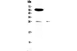 Western blot analysis of CTLA4 using anti-CTLA4 antibody . (CTLA4 抗体  (AA 36-161))