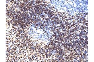LAT (pY226) staining on tonsil. (LAT 抗体  (pTyr226))