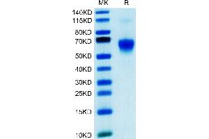 SDS-PAGE (SDS) image for Lectin, Galactoside-Binding, Soluble, 9 (LGALS9) (AA 2-323) protein (His tag) (ABIN7274751)