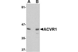 Western blot analysis of ACVR1 in A549 cell lysate with AP30014PU-N ACVR1 antibody at 1 μg/ml in (A) the absence and (B) the presence of blocking peptide. (ACVR1 抗体  (N-Term))