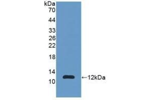 Detection of Recombinant S100A11, Human using Polyclonal Antibody to S100 Calcium Binding Protein A11 (S100A11) (S100A11 抗体  (AA 1-105))