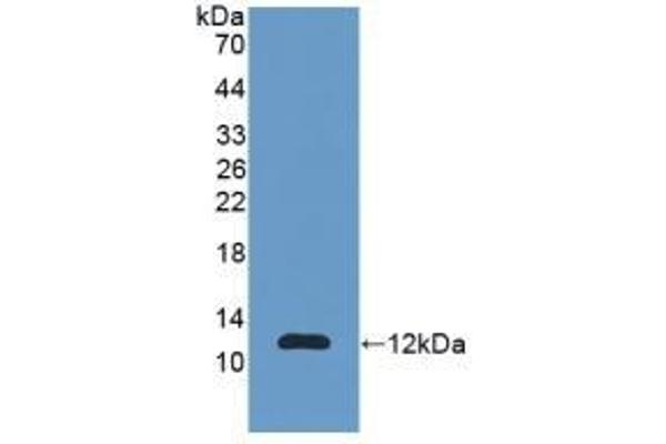 S100A11 anticorps  (AA 1-105)