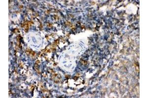 IHC-P: TGM2 antibody testing of rat spleen tissue (Transglutaminase 2 抗体)