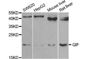 Western blot analysis of extracts of various cell lines, using GIP antibody (ABIN5973668) at 1/1000 dilution. (GIP 抗体)