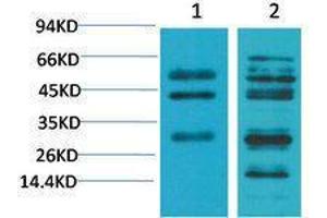 Western Blotting (WB) image for anti-Transforming Growth Factor, beta 1 (TGFB1) antibody (ABIN3181578) (TGFB1 抗体)