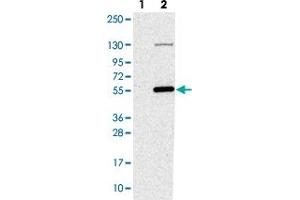 Western blot analysis of Lane 1: Negative control (vector only transfected HEK293T lysate). (NAT16 抗体)
