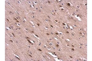 Immunohistochemistry (IHC) image for anti-Von Hippel-Lindau Tumor Suppressor, E3 Ubiquitin Protein Ligase (VHL) antibody (ABIN2854928)
