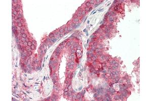 Human Prostate: Formalin-Fixed, Paraffin-Embedded (FFPE).