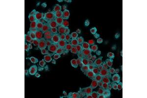 Immunofluorescence Analysis of RAW cells labeling KRT6 with KRT6 Mouse Monoclonal Antibody (SPM269) followed by Goat anti-Mouse IgG-CF488 (Cyan). (KRT6A/KRT6B/KRT6C (C-Term) 抗体)