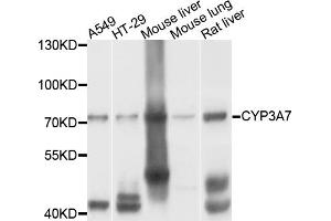 Western blot analysis of extracts of various cell lines, using CYP3A7 antibody. (CYP3A7 抗体)
