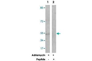Western blot analysis of extracts from HUVEC cells, treated with Adriamycin (0. (Caspase 2 抗体  (Ser140))