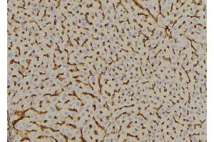 ABIN6269059 at 1/100 staining Mouse liver tissue by IHC-P. (DOK2 抗体  (Internal Region))
