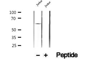 Western blot analysis of extracts of Jurkat cells, using HPSE antibody. (HPSE 抗体  (Internal Region))