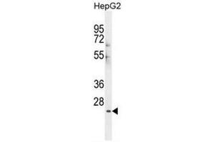 CES4 Antibody (N-term) western blot analysis in HepG2 cell line lysates (35µg/lane). (CES1P1 抗体  (N-Term))