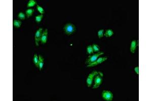 Immunofluorescent analysis of HepG2 cells using ABIN7165334 at dilution of 1:100 and Alexa Fluor 488-congugated AffiniPure Goat Anti-Rabbit IgG(H+L) (EVI2A 抗体  (AA 31-133))