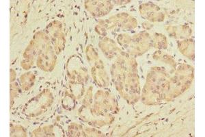 Immunohistochemistry of paraffin-embedded human pancreatic tissue using ABIN7149799 at dilution of 1:100 (DET1 抗体  (AA 15-240))