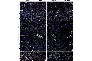 Fgfr1 and Fgfr2 expression during postnatal lung development. (ADRP 抗体  (N-Term))