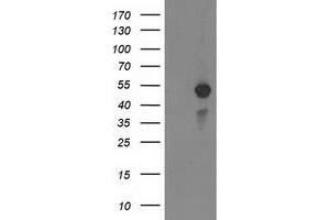 Western Blotting (WB) image for anti-Myocyte Enhancer Factor 2C (MEF2C) antibody (ABIN1499362) (MEF2C 抗体)