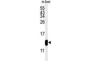 Western blot analysis of TMIE Antibody (Center) in mouse liver tissue lysates (35 µg/lane). (TMIE 抗体  (Middle Region))